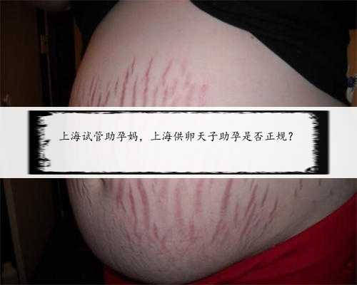 上海试管助孕妈，上海供卵天子助孕是否正规？