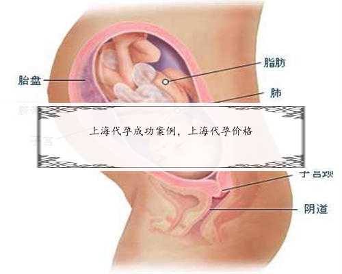 上海代孕成功案例，上海代孕价格