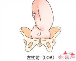 上海国内借卵子生子可行吗，月经过多会导致低血压吗
