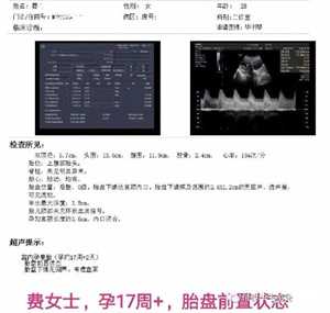 上海知名代怀孕多少钱，美国试管婴儿孕期准妈妈需要补充哪些营养素呢？